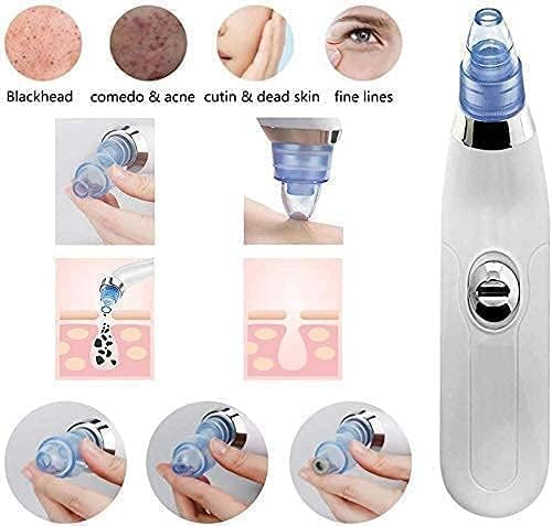 4 In 1 Blackhead Whitehead Extractor Remover Device Acne Pimple Pore Cleaner (Vacuum Suction Tool)